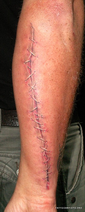 Img125606_scar.jpg