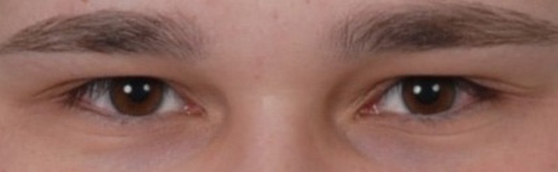 Augen.jpg