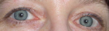 beide Augen.jpg