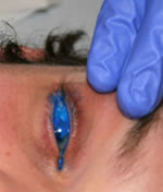 eyeball-tattooing.jpg