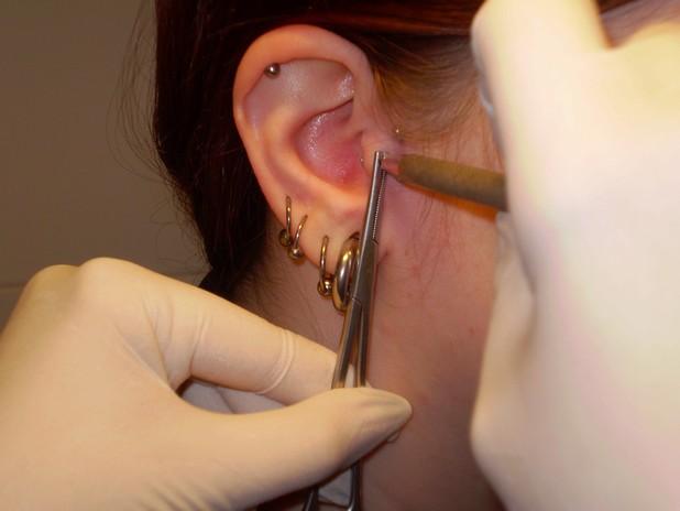 tragus3.JPG