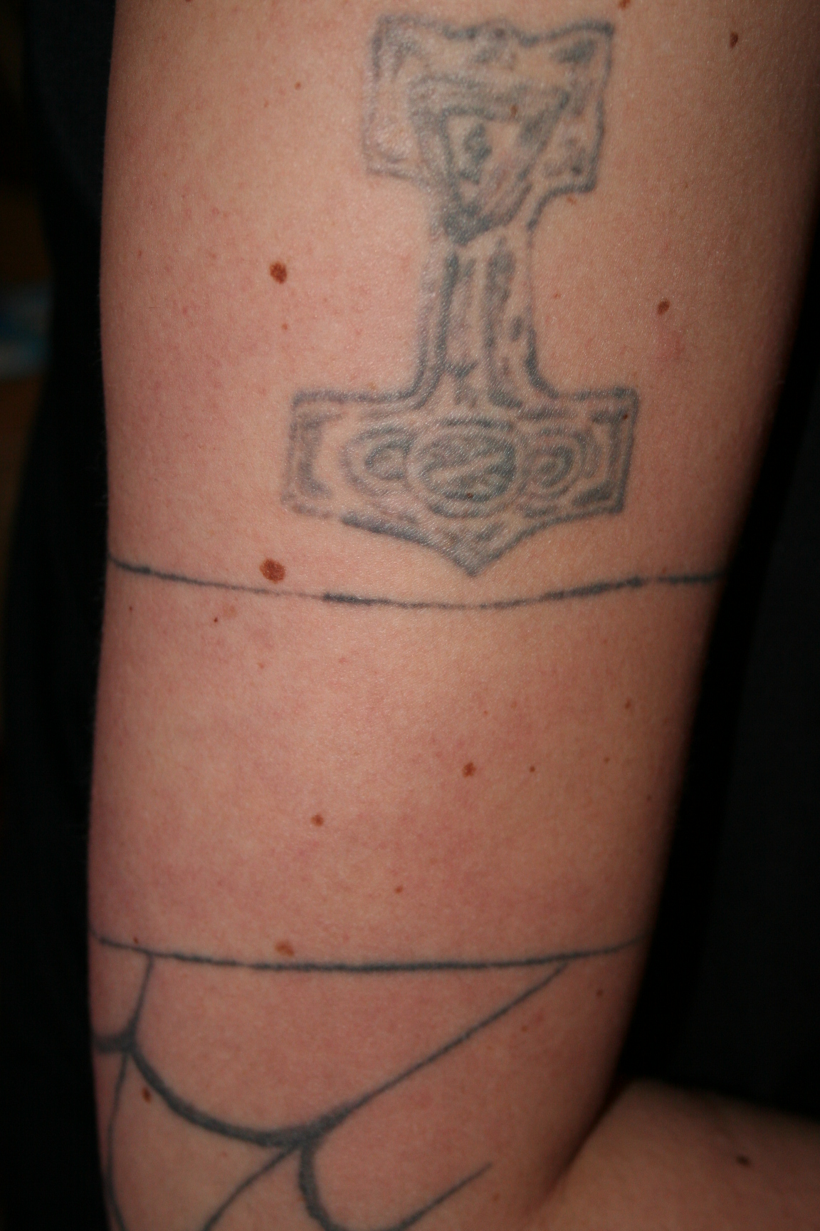 ganzer o-arm.JPG