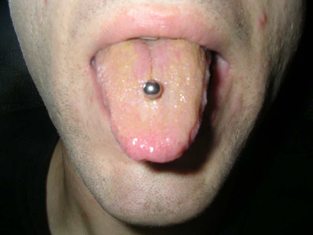 Zungenpiercing 001.jpg