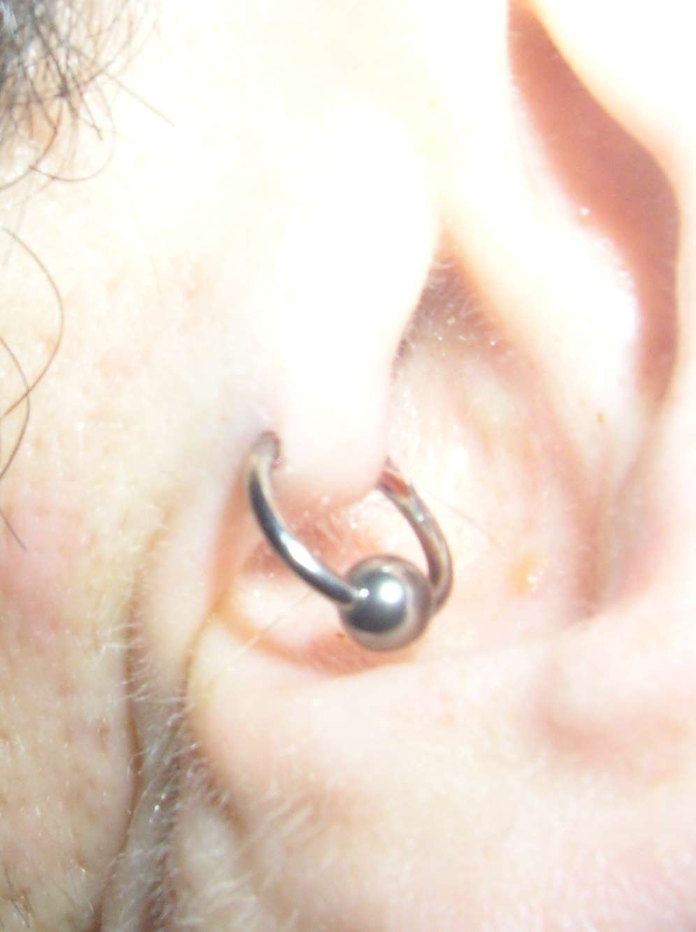 Tragus.jpg