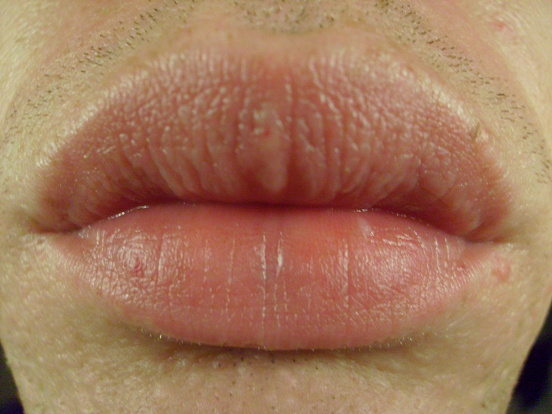 Lips.JPG