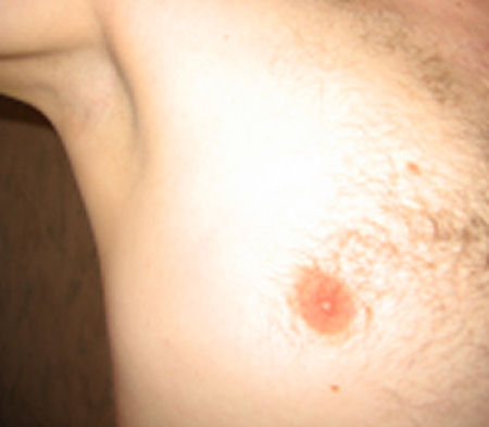 nippel.jpg