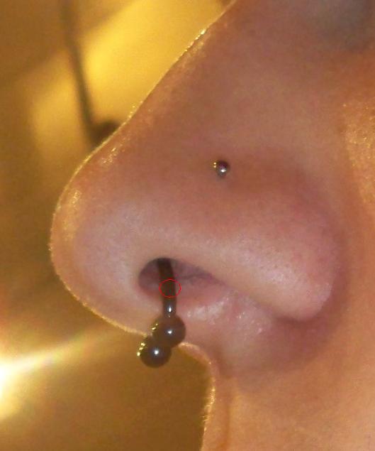 septum.jpg
