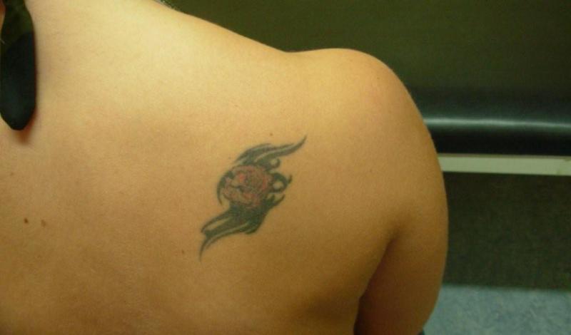 Tattoo-vorher.jpg