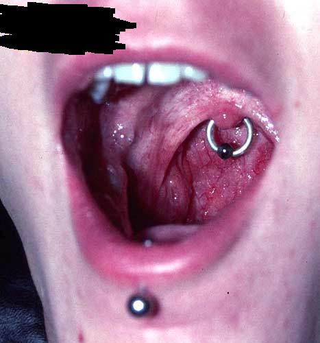 Uvula_Piercing-1.jpg