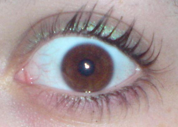 Auge.jpg
