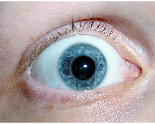 auge.jpg