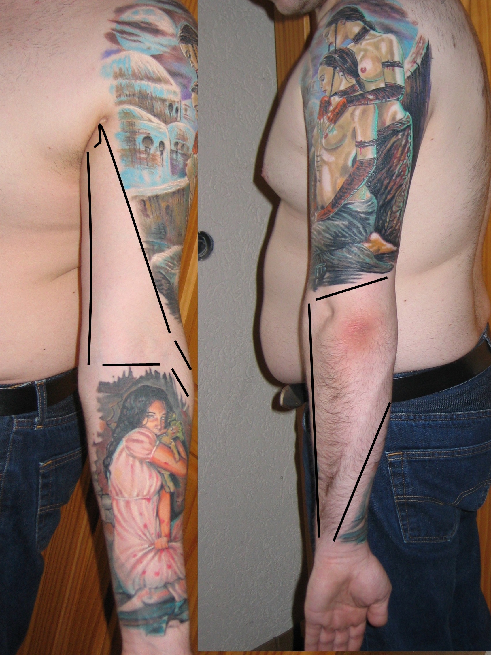 Arm-marked.jpg