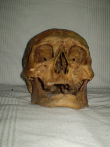 head.JPG