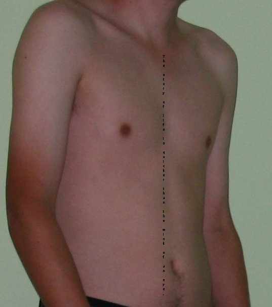 Male_torso.png