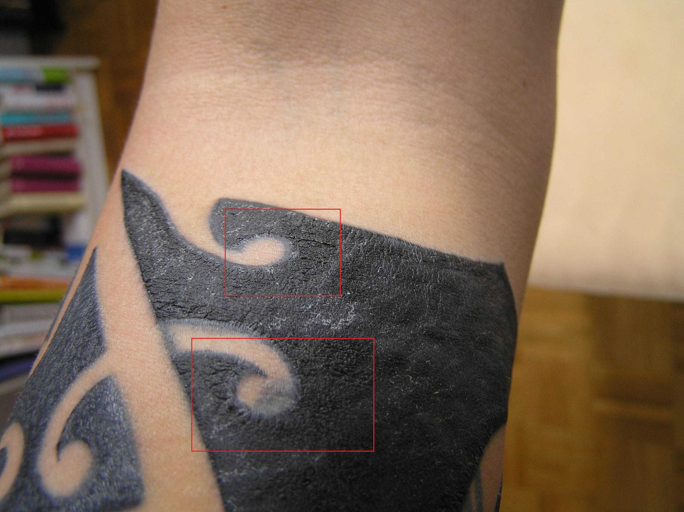Arm1.jpg