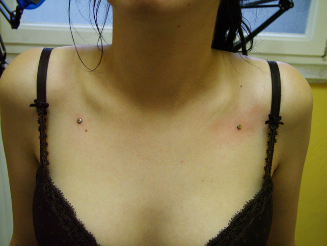 Micro Dermal 3.jpg