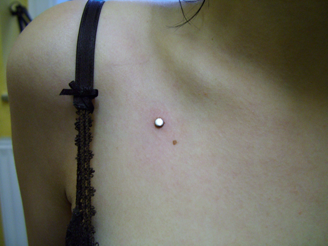 Micro Dermal 1.jpg