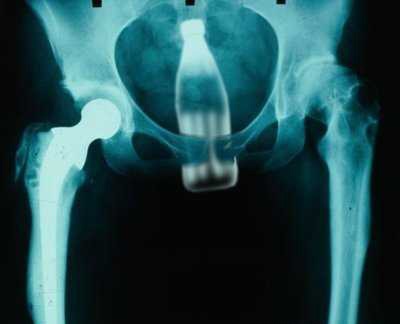 x-ray.jpg