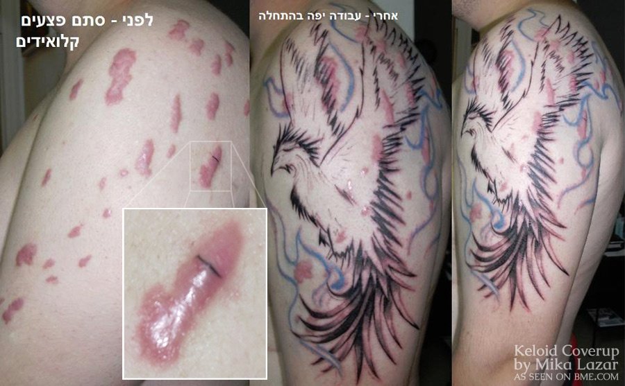 dan-keloid-phoenix-1.jpg