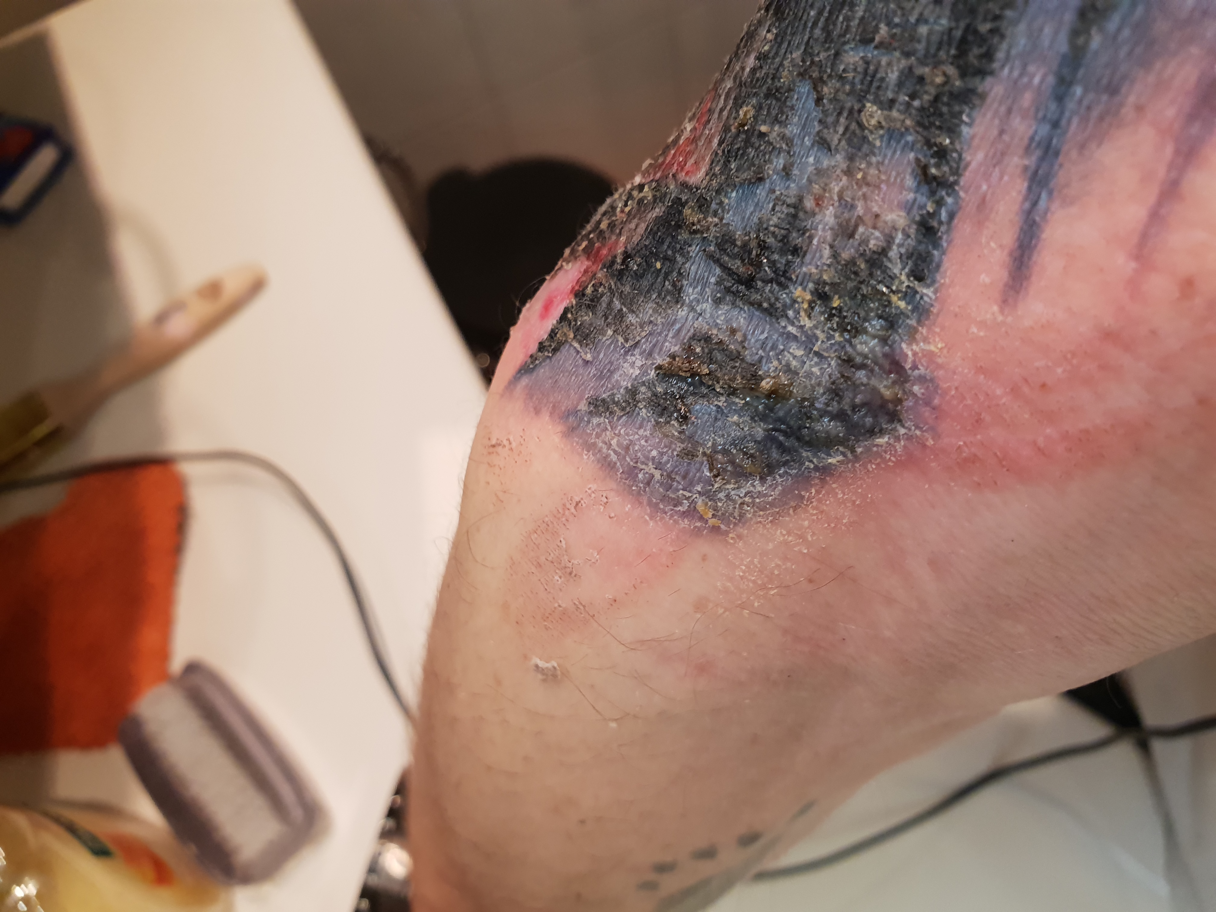 Tattoo schaut Komisch aus Entz det Tattoopflege Tattoo schaut Komisch aus Entz det Tattoopflege