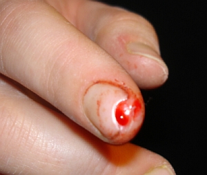 fingerkuppe.jpg
