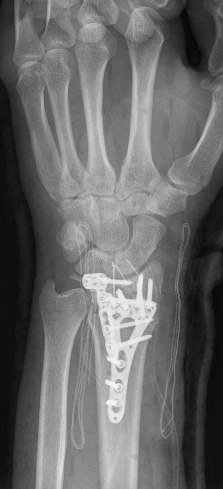 Hand Draufsicht.JPG