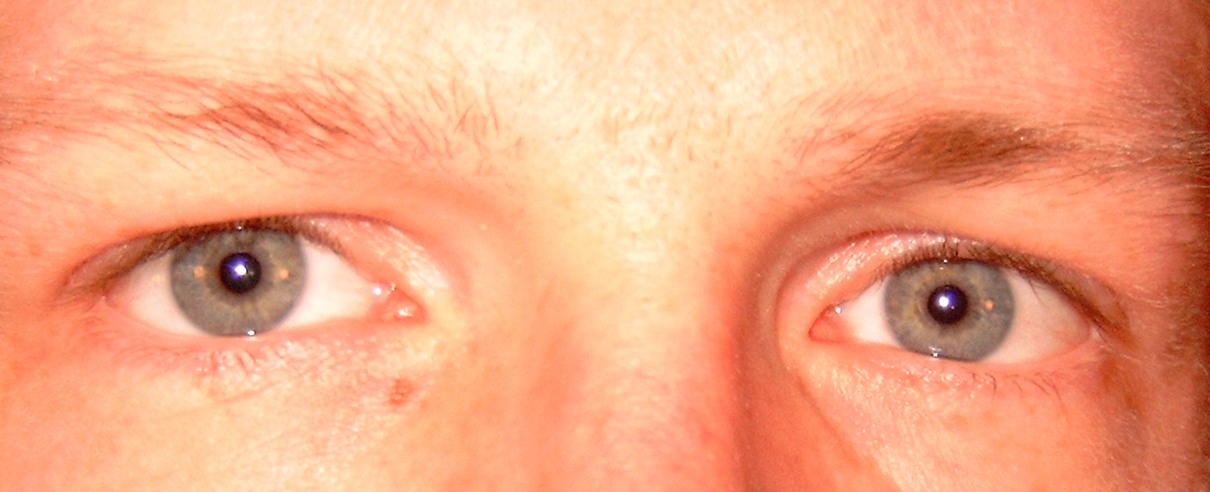 Augen_1.JPG